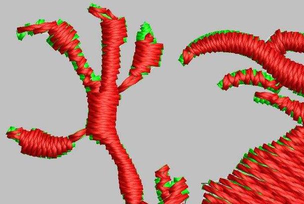 平包針寬窄如何調(diào)整?平包針寬窄調(diào)整方法 平包針寬窄如何調(diào)整?平包針寬窄調(diào)整方法